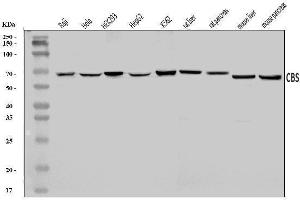 Western blot analysis of CBS using anti-CBS antibody (ABIN7599637).
