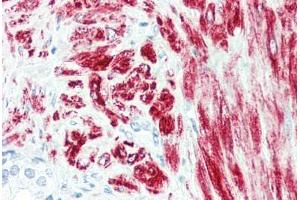 Human Prostate (formalin-fixed, paraffin-embedded) stained with DES antibody ABIN396919 at 10 ug/ml followed by biotinylated anti-mouse IgG secondary antibody ABIN481714, alkaline phosphatase-streptavidin and chromogen. (Desmin 抗体)