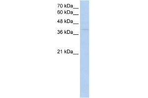 WB Suggested Anti-RNF165 Antibody Titration:  0. (RNF165 抗体  (Middle Region))