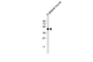 Anti-AGPHD1 Antibody (N-Term)at 1:2000 dilution + human skeletal muscle lysates Lysates/proteins at 20 μg per lane. (AGPHD1 抗体  (AA 65-99))