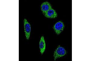 Confocal immunofluorescent analysis of ADRA2B Antibody (Center) (ABIN652506 and ABIN2842340) with MDA-M cell followed by Alexa Fluor® 488-conjugated goat anti-rabbit lgG (green). (ADRA2B 抗体  (AA 343-369))