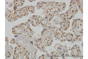 Immunoperoxidase of monoclonal antibody to SMAD3 on formalin-fixed paraffin-embedded human placenta. (SMAD3 抗体  (AA 120-221))