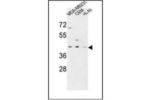 Western blot analysis of PRPF38A Antibody (C-term) in MDA-MB231,CEM,HL-60 cell line lysates (35ug/lane).
