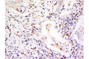 Immunohistochemistry (Paraffin-embedded Sections) (IHC (p)) image for anti-Killer Cell Lectin-Like Receptor Subfamily D, Member 1 (KLRD1) (AA 71-179) antibody (ABIN741480)
