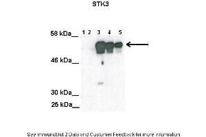 Lanes:   Lane1: 100ug untransfected COS-7 lysate Lane2: 100ug mock transfected Cos-7 lysate Lane3: 100ug STK3 transfected Cos-7 lysate Lane4: 50 ug STK3 transfected Cos-7 lysate Lane5: 25 ug STK3 transfected Cos-7 lysate  Primary Antibody Dilution:   1:2000  Secondary Antibody:   Anti-rabbit HRP  Secondary Antibody Dilution:   1:5000  Gene Name:   STK3  Submitted by:   Anonymous (STK3 抗体  (C-Term))