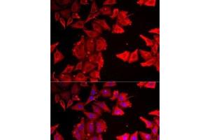 Immunofluorescence analysis of MCF7 cells using THRSP Polyclonal Antibody (THRSP 抗体)