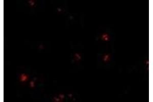 Immunofluorescence of LASS5 in human brain tissue with this product at 20 μg/ml. (LASS5 抗体  (C-Term))