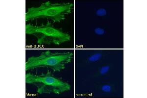 ABIN5539774 Immunofluorescence analysis of paraformaldehyde fixed HeLa cells, permeabilized with 0. (GLP1R 抗体  (Internal Region))