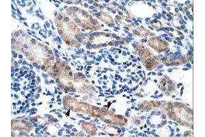 Image no. 1 for anti-Chloride Intracellular Channel 1 (CLIC1) (AA 62-111) antibody (ABIN202109) (CLIC1 抗体  (AA 62-111))