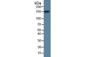 Rabbit Detection antibody from the kit in WB with Positive Control: Sample Mouse serum. (SLIT1 ELISA 试剂盒)