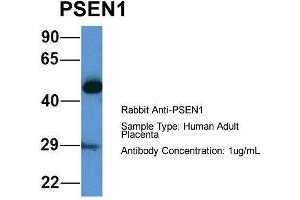 Host: Rabbit  Target Name: PSEN1  Sample Tissue: Human Adult Placenta  Antibody Dilution: 1. (Presenilin 1 抗体  (Middle Region))