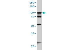 ACTN4 monoclonal antibody (M01A), clone 4D10 Western Blot analysis of ACTN4 expression in Hela S3 NE .