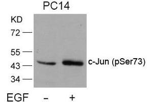Western blot analysis of extracts from PC14 cells untreated or treated with EGF using c-Jun(Phospho-Ser73) Antibody. (C-JUN 抗体  (pSer73))