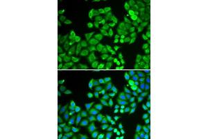 Immunofluorescence analysis of U2OS cells using PPP4C antibody. (PPP4C 抗体  (AA 1-307))