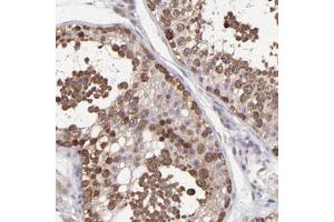 Immunohistochemical staining of human testis with NSF polyclonal antibody  shows cytoplasmic positivity in cells of seminiferus ducts at 1:50-1:200 dilution. (NSF 抗体)