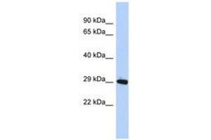 Image no. 1 for anti-Zinc Finger Protein 524 (ZNF524) (AA 35-84) antibody (ABIN6740642) (ZNF524 抗体  (AA 35-84))