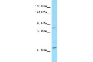 Western Blotting (WB) image for anti-Desmoglein 1 (DSG1) (C-Term) antibody (ABIN2789462) (Desmoglein 1 抗体  (C-Term))