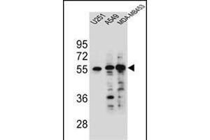 SYNCI Antibody (N-term) (ABIN654757 and ABIN2844441) western blot analysis in ,A549 and MDA-M cell line lysates (35 μg/lane). (Syncoilin 抗体  (N-Term))
