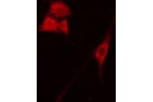 Immunofluorescence (fixed cells) (IF/ICC) image for anti-Breakpoint Cluster Region (BCR) (pTyr360) antibody (ABIN6256715)