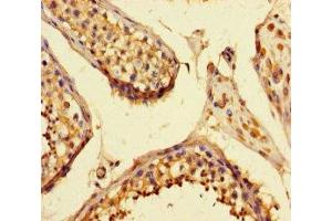 Immunohistochemistry of paraffin-embedded human testis tissue using ABIN7168986 at dilution of 1:100 (STK25 抗体  (AA 1-426))