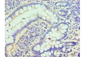 Immunohistochemistry of paraffin-embedded human small intestine tissue using ABIN7147585 at dilution of 1:100 (CLIC1 抗体  (AA 42-241))