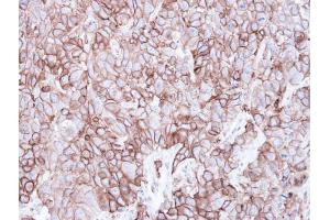 IHC-P Image Immunohistochemical analysis of paraffin-embedded FaDu xenograft, using Caveolin 2, antibody at 1:500 dilution. (Caveolin 2 抗体  (N-Term))