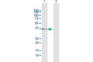 Western Blot analysis of CFHR1 expression in transfected 293T cell line by CFHR1 MaxPab polyclonal antibody.