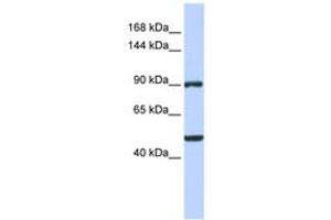 Image no. 1 for anti-Zinc Finger Protein 217 (ZNF217) (AA 540-589) antibody (ABIN6742392) (ZNF217 抗体  (AA 540-589))