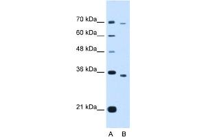 WB Suggested Anti-PHF6 Antibody Titration:  1. (PHF6 抗体  (Middle Region))