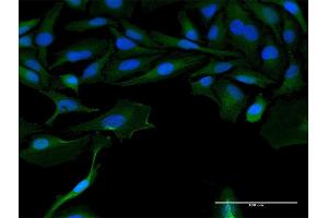 Immunofluorescence of purified MaxPab antibody to LOC541473 on HeLa cell. (LOC541473 抗体  (AA 1-131))
