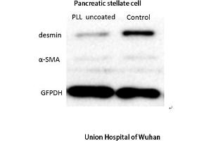 anti-Desmin (DES) (AA 390-470) antibody