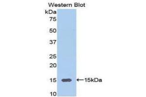 Western Blotting (WB) image for anti-Alanine Aminotransferase (ALT) (AA 367-480) antibody (ABIN1077756) (ALT 抗体  (AA 367-480))