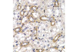 Immunohistochemistry (IHC) image for anti-CD38 (AA 1-300) antibody (ABIN1679089) (CD38 抗体  (AA 1-300))
