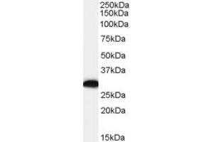 Western Blotting (WB) image for anti-Arginine Decarboxylase (ADC) (C-Term) antibody (ABIN2156351) (ADC 抗体  (C-Term))