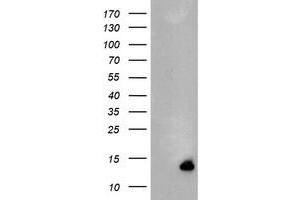 Image no. 1 for anti-Chromosome 17 Open Reading Frame 37 (C17orf37) antibody (ABIN1501776) (C17orf37 抗体)