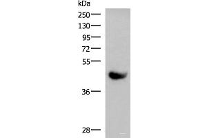 Western blot analysis of Human plasma solution using KIR2DL5A Polyclonal Antibody at dilution of 1:1000 (KIR2DL5A 抗体)