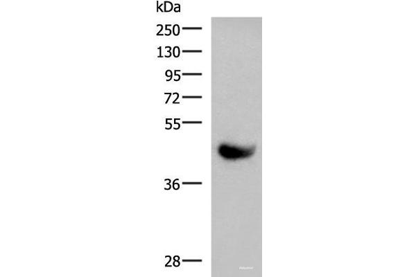 KIR2DL5A 抗体