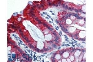 Immunohistochemistry of paraffin-embedded sections (kidney) Immunohistochemistry staining of human kidney (paraffin-embedded sections)  Fig. (Cytokeratin 18 抗体)