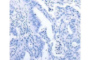 Immunohistochemistry (IHC) image for anti-Gem (Nuclear Organelle) Associated Protein 2 (GEMIN2) antibody (ABIN1872798) (SIP1 抗体)