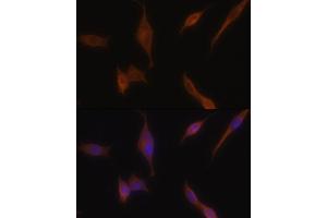 Immunofluorescence analysis of NIH-3T3 cells using MLPH antibody (ABIN6128273, ABIN6143892, ABIN6143893 and ABIN6222354) at dilution of 1:100. (Melanophilin 抗体  (AA 301-600))