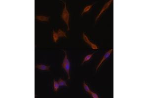 Immunofluorescence analysis of NIH-3T3 cells using MLPH antibody (ABIN6128273, ABIN6143892, ABIN6143893 and ABIN6222354) at dilution of 1:100. (Melanophilin 抗体  (AA 301-600))