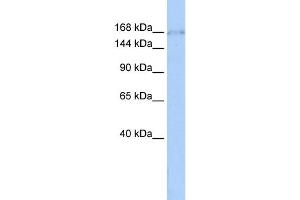 WB Suggested Anti-ZNF608 Antibody Titration:  0. (ZNF608 抗体  (Middle Region))