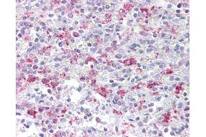 Anti-EZH1 antibody IHC of human spleen. (EZH1 抗体  (N-Term))
