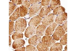 Immunohistochemical analysis of paraffin-embedded human skeletal muscle using Raptor antibody at 1:25 dilution. (RAPTOR 抗体)