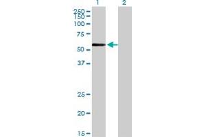 Western Blot analysis of ZNF165 expression in transfected 293T cell line by ZNF165 monoclonal antibody (M02), clone 2B8. (ZNF165 抗体  (AA 1-485))
