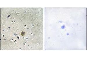 Immunohistochemistry analysis of paraffin-embedded human brain tissue, using MEK1 (Ab-298) Antibody. (MEK1 抗体  (AA 264-313))