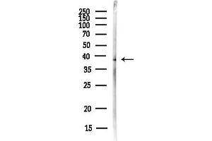 anti-Solute Carrier Family 25, Member 37 (SLC25A37) antibody