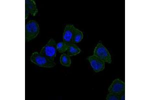 Immunofluorescence analysis of HepG2 cells using HFE mouse mAb (green). (HFE 抗体)