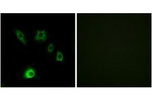 Immunofluorescence analysis of HuvEc cells, using FGF18 Antibody.