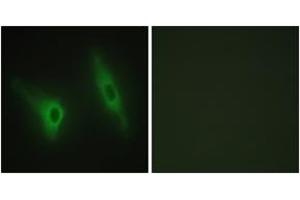 Immunofluorescence analysis of HeLa cells, using CKI-epsilon Antibody. (CK1 epsilon 抗体  (AA 276-325))